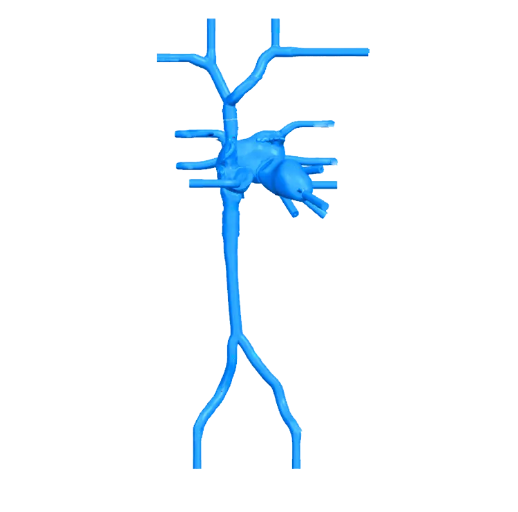 Transseptal Puncture Vessel Model - Type B