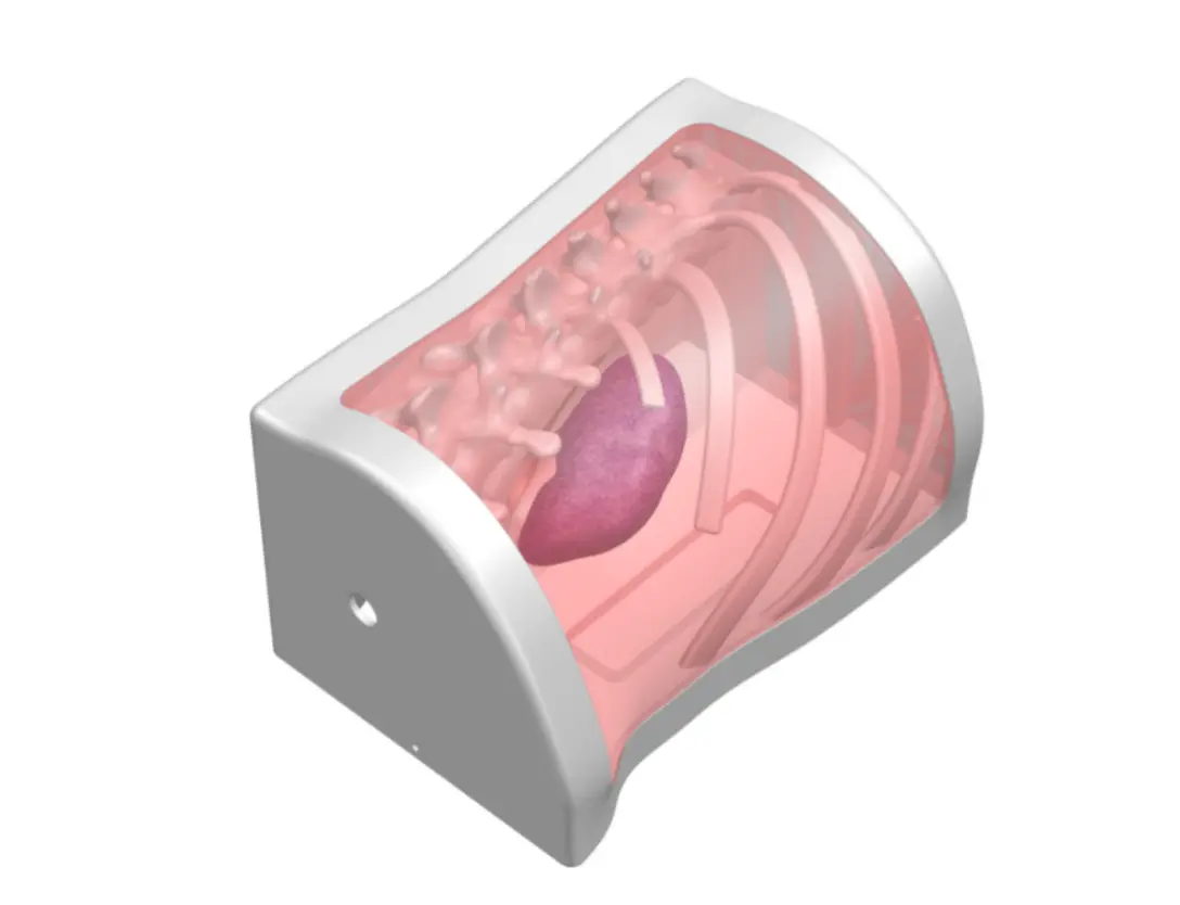 Drawing of Percutaneous nephrolithotomy puncture model